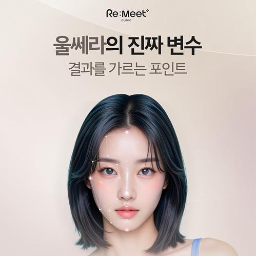 리밋의원 울쎄라