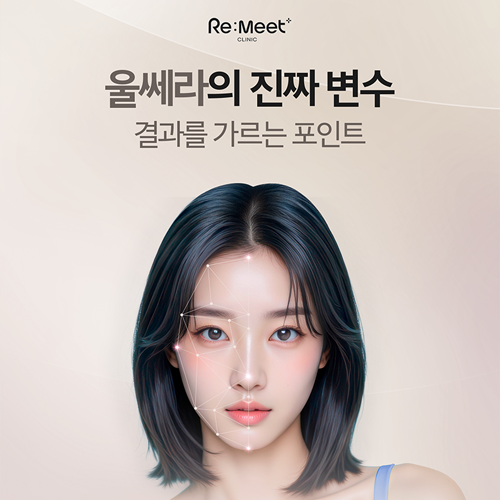 의정부 울쎄라
